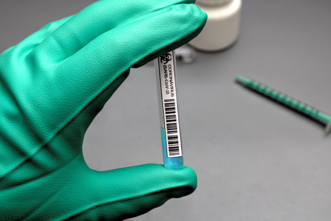 Corona-Schnelltest 